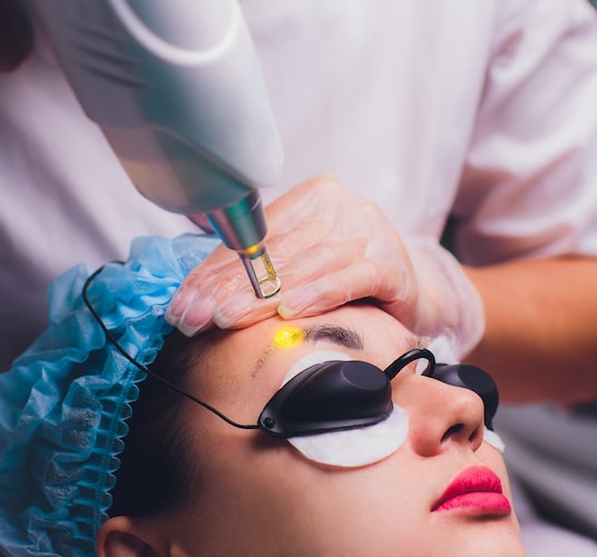 Permanent Makeup Laser Removal in Fort Myers, Florida